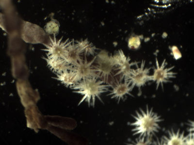 Microscope image of juvenile purple sea urchins. 