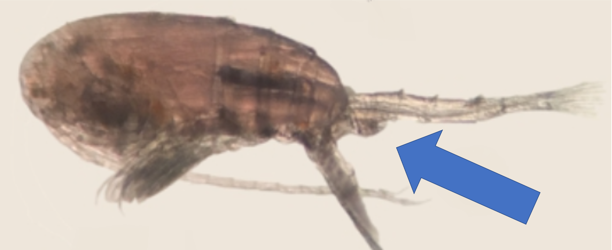 female copepod under a microscope, with an arrow pointing toward the tail